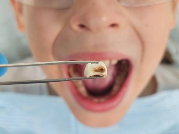 Emergency Dentist for Kids in IL